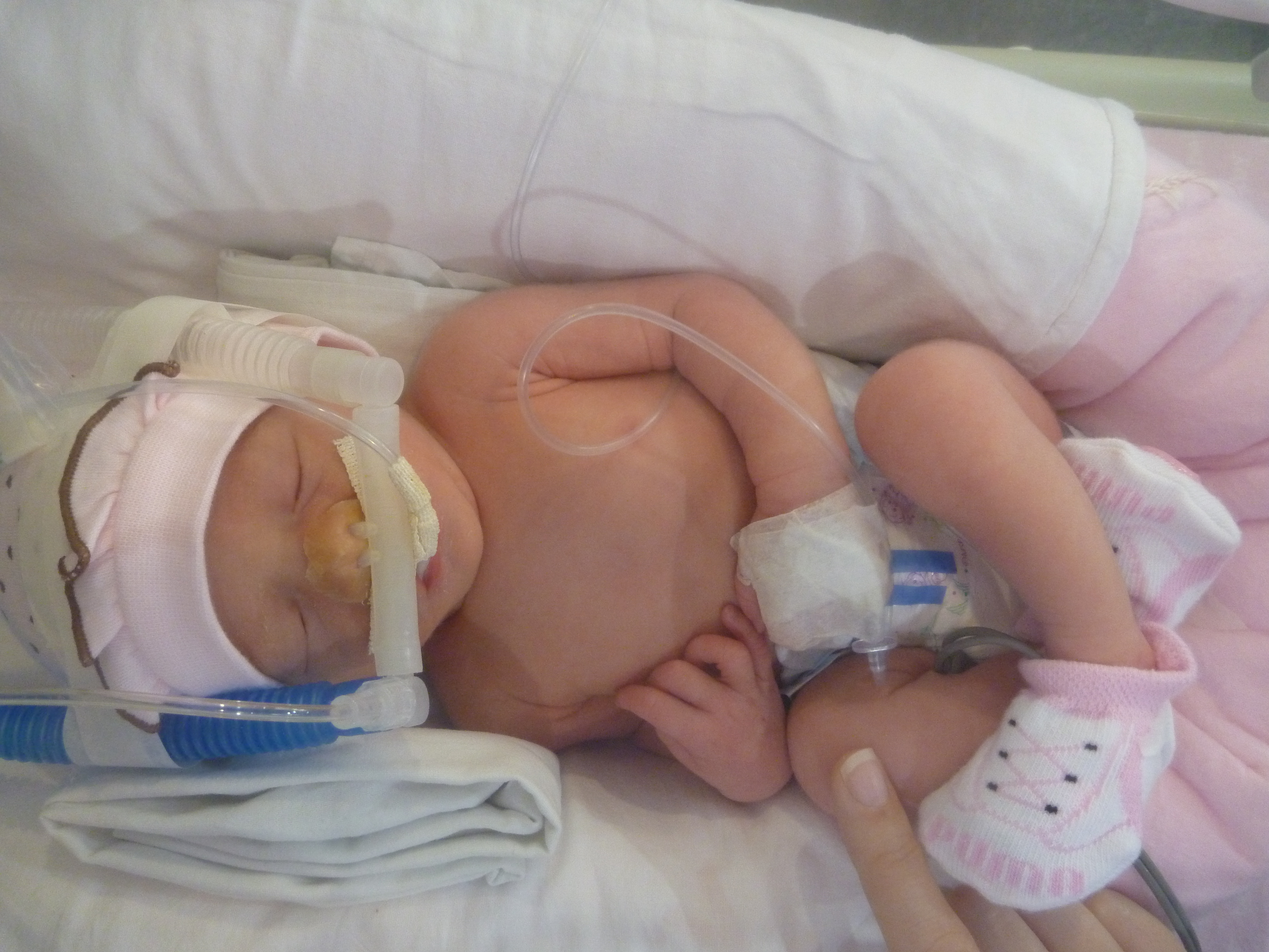 28 Days in a Brazilian NICU: The Mom Milking Room